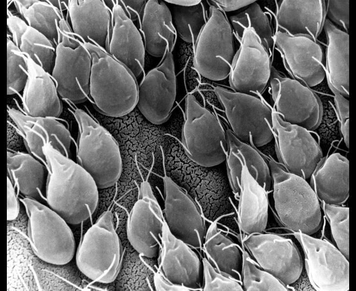 Giardia